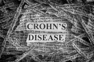 Lees meer over het artikel De behandeling van de ziekte van Crohn