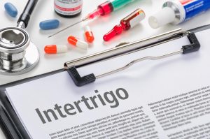 Lees meer over het artikel Smetplekken
